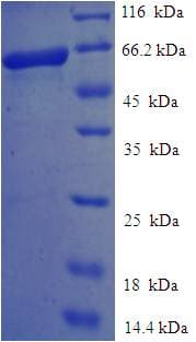 Human NEIL1 Protein (Recombinant His-SUMO)
