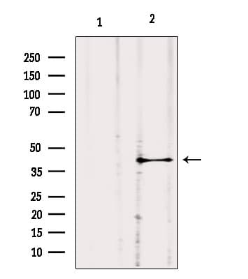Polyclonal Rabbit anti-Human GNA11 Antibody (IHC, WB)