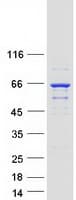 Human DPYSL4 / CRMP3 Protein (Recombinant Myc-DDK (Flag))