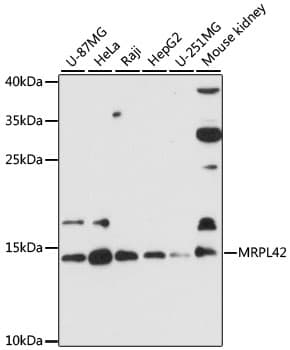 Polyclonal Rabbit anti-Human MRPL42 / MRPS32 Antibody (WB)