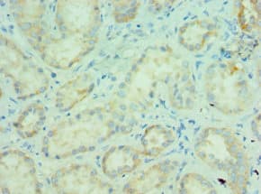 MLANA / Melan-A Antibody (aa48-118)