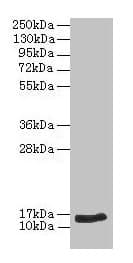NPPB / BNP Antibody (aa27-101)