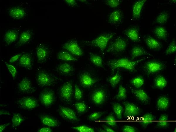 Monoclonal Mouse anti-Human UBE2L3 / UBCH7 Antibody (clone 3B7, IF, WB)