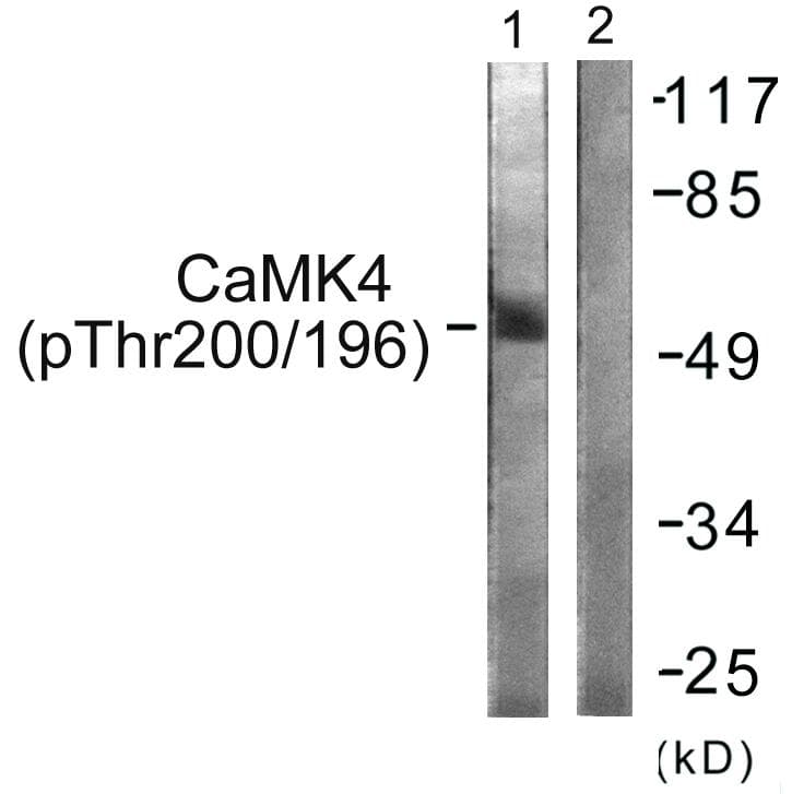 CAMK4 / CaMK IV Antibody (phospho-Thr196/200)