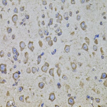 CRFR1 / CRHR1 Antibody