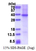 Human SFRP2 Protein (Recombinant His)