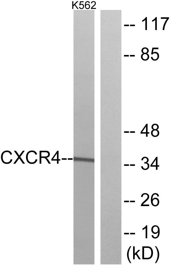 IHC-plus™ Polyclonal Rabbit anti-Human CXCR4 Antibody (aa300-349, IHC, IF, WB)