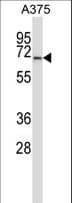 Polyclonal Rabbit anti-Human PPP3CA / CCN1 / Calcineurin A Antibody (aa438-466, WB)