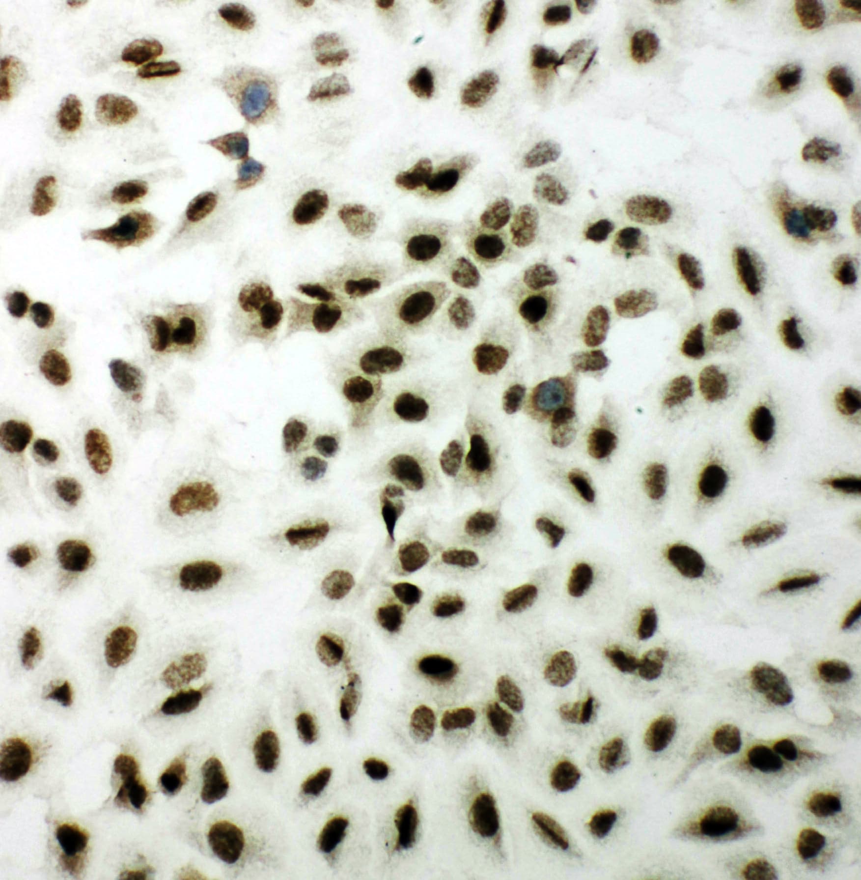XRCC1 Antibody (aa15-34)