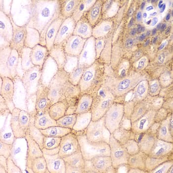 CLDN1 / Claudin 1 Antibody