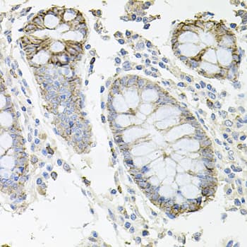 ATP1B1 Antibody