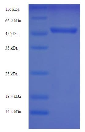 Human UCHL5 / UCH37 Protein (Recombinant His-SUMO)