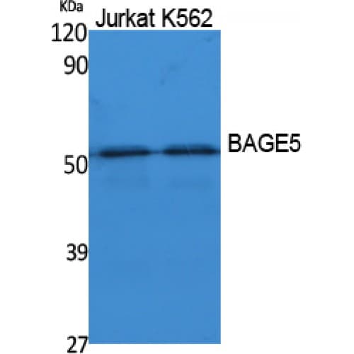 BAG5 Antibody (30-110 aa, N-terminal)
