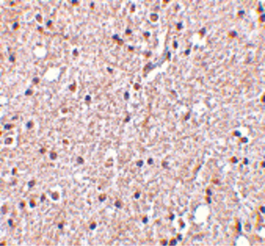 Polyclonal Rabbit anti-Human BRSK2 Antibody (IHC, IF, WB)