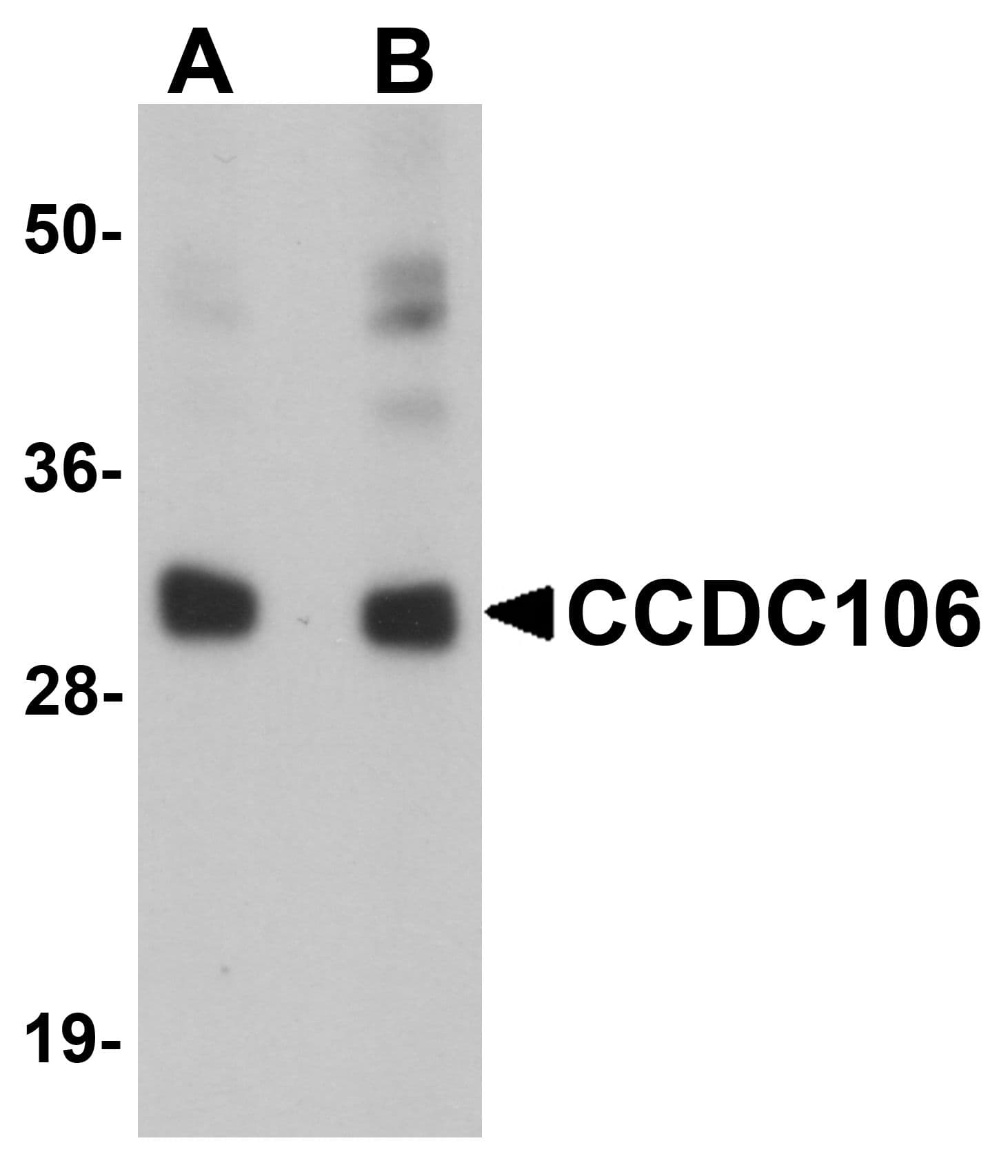 IHC-plus™ Polyclonal Rabbit anti-Human CCDC106 Antibody (IHC, IF, WB)
