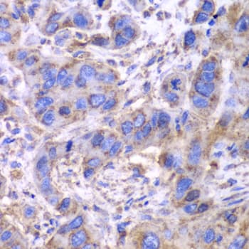 IHC-plus™ SDHA Antibody