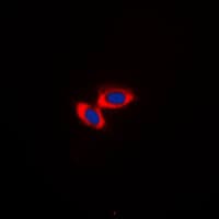 CD3D Antibody (Internal)