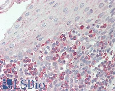 CSF1R / CD115 / FMS Antibody (aa768-928)