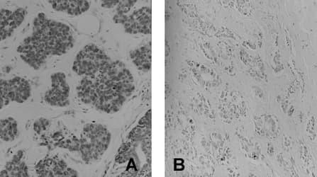 4-Amino Biphenyl DNA Antibody (clone 4C11)