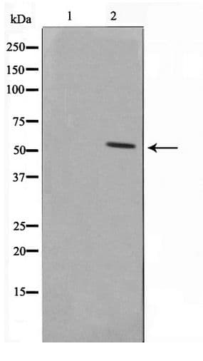 Polyclonal Rabbit anti-Human NAB2 Antibody (IHC, WB)
