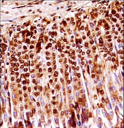 Polyclonal Rabbit anti-Mouse MAP2K1 / MKK1 / MEK1 Antibody (aa269-296, IHC, WB)