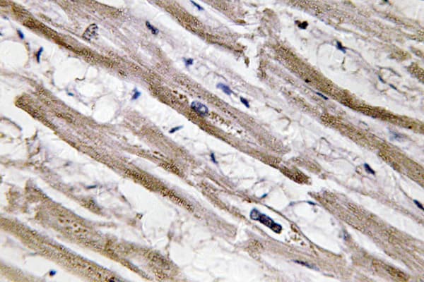 KRT13 / CK13 / Cytokeratin 13 Antibody (Glu282)