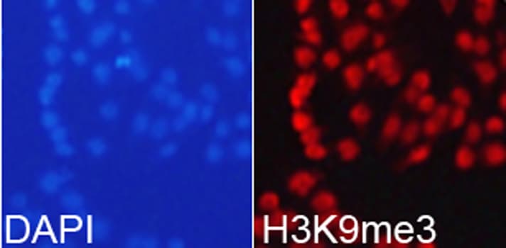 Histone H3 Antibody (Tri-Methyl-Lys9)