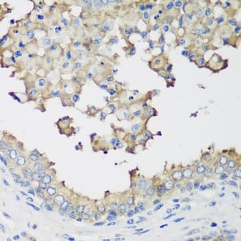 Polyclonal Rabbit anti-Human NEDD4L / NEDD4-2 Antibody (IHC, WB)