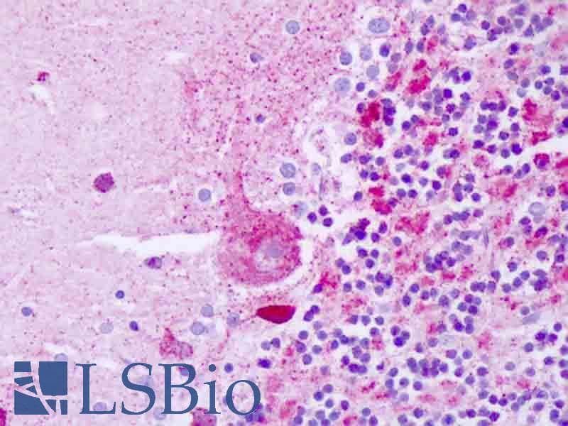 IHC-plus™ TNFRSF10B / Killer / DR5 Antibody