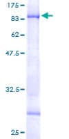 Human CHST15 Protein (Recombinant GST)