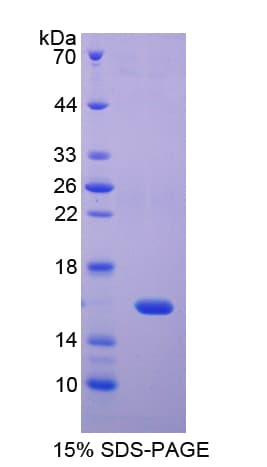 Rat REG4 / REG-IV Protein (Recombinant His-T7)