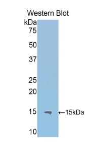 IL13RA2 / IL13R Alpha 2 Antibody (aa228-338)