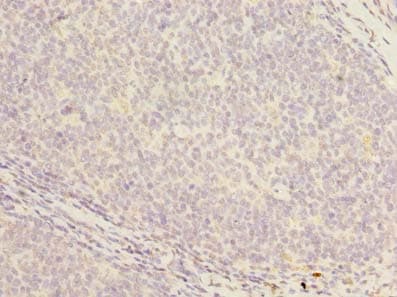 PCOLCE2 Antibody