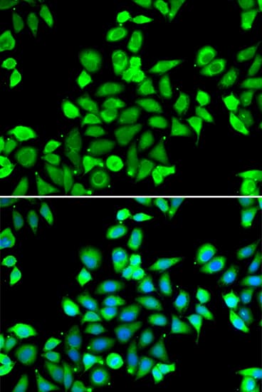 APC6 / CDC16 Antibody
