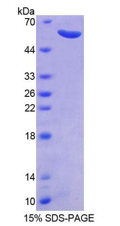 Human CAPNS1 / CAPN4 Protein (Recombinant His-GST)