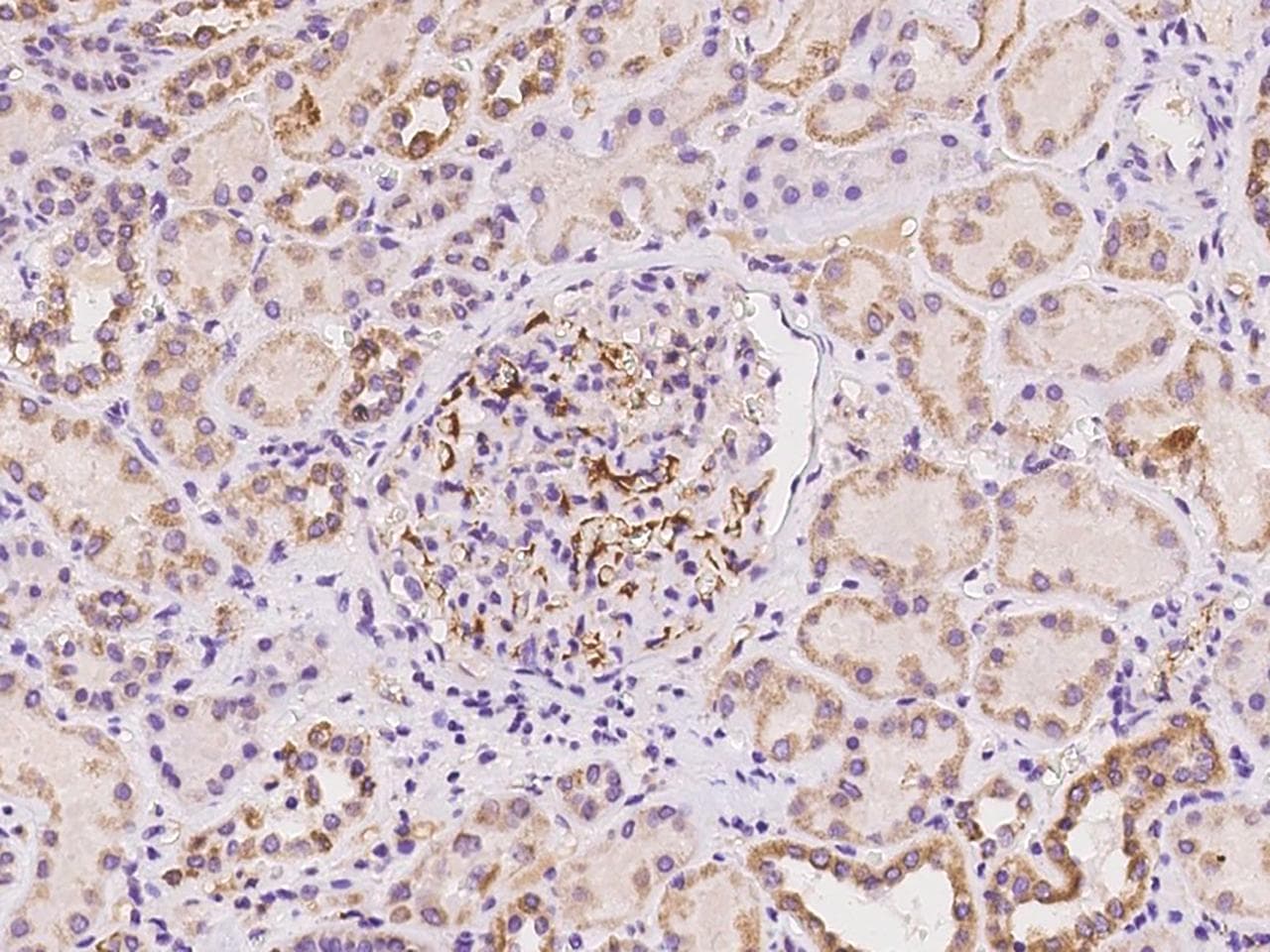 APOC2 / Apolipoprotein C II Antibody