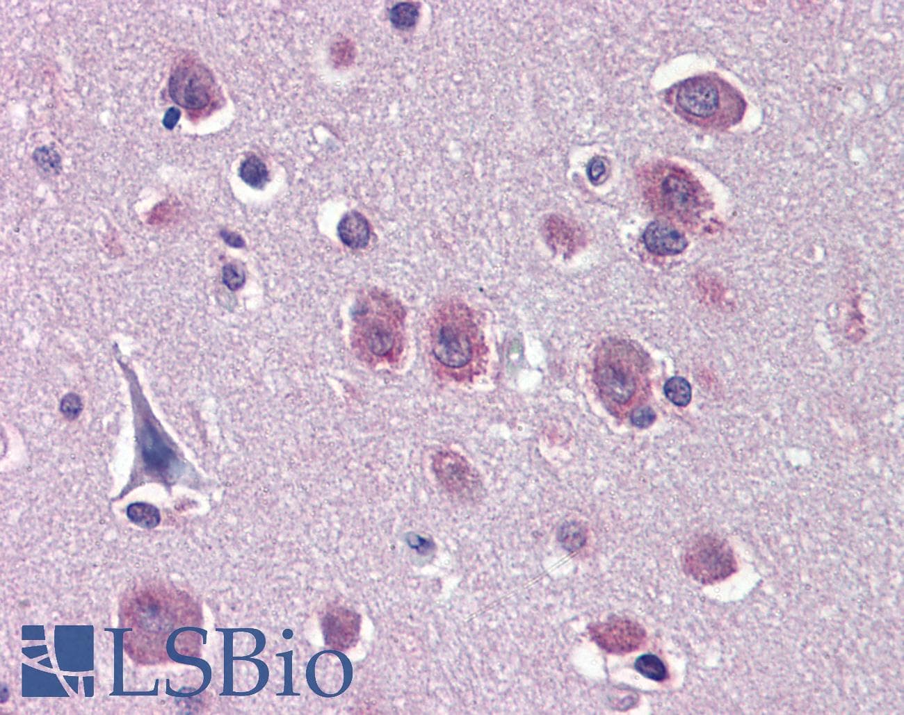 IHC-plus™ HDAC3 Antibody (clone 7G6C5)