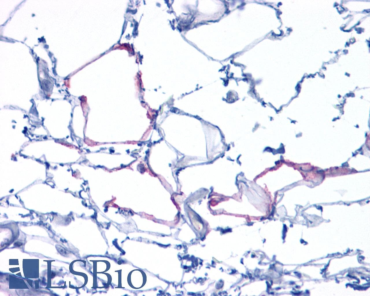 IHC-plus™ Polyclonal Rabbit anti-Human GCGR / Glucagon Receptor Antibody (N-Terminus, IHC)