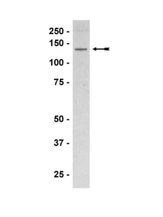 IHC-plus™ Polyclonal Rabbit anti-Human NOS3 / eNOS Antibody (aa1181-1194, IHC, WB)