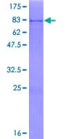 Human PCCB Protein (Recombinant GST)