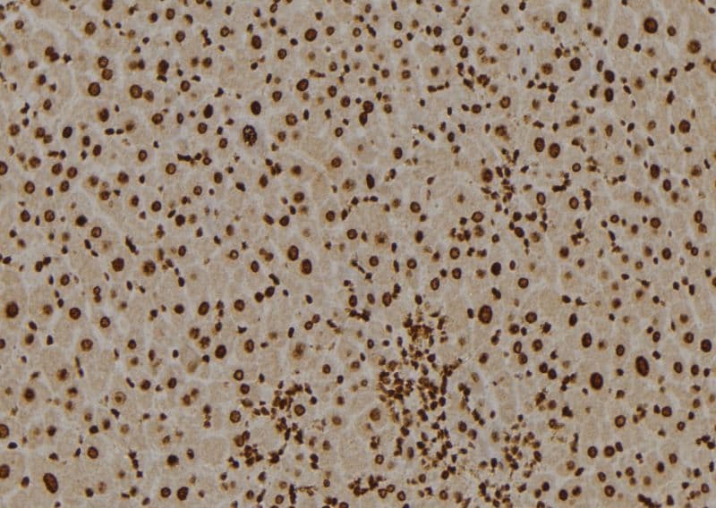 Polyclonal Rabbit anti-Human BCL10 / BCL-10 Antibody (IHC, WB)