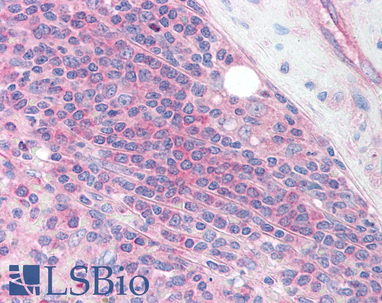 IHC-plus™ IKBKG / NEMO / IKK Gamma Antibody