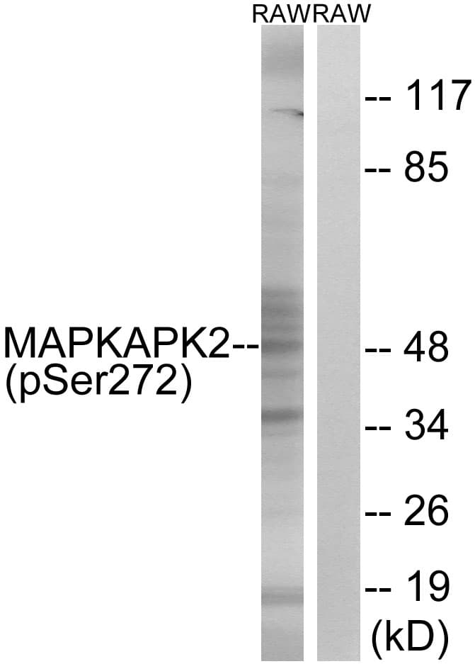 MAPKAPK2 / MAPKAP Kinase 2 Antibody (phospho-Ser272)
