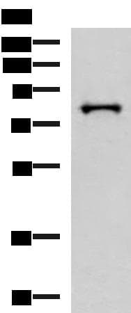 Polyclonal Rabbit anti-Human PRPF3 Antibody (IHC, WB)