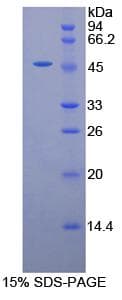 Human GLA / Alpha Galactosidase Protein (Recombinant His-S)