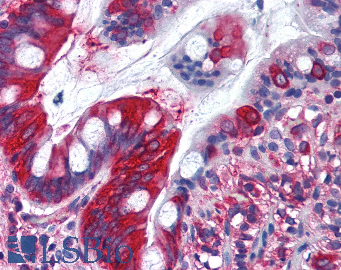 IHC-plus™ TFG Antibody (aa350-400)