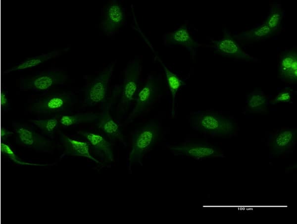 CML / BCR Antibody (clone 2E5)