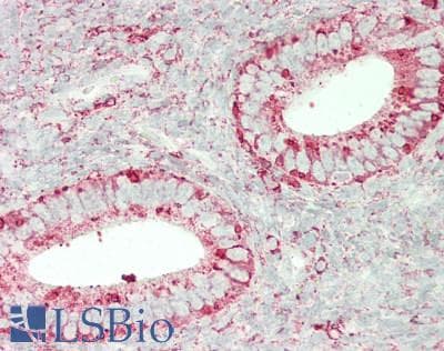 IHC-plus™ Monoclonal Mouse anti-Human Endonuclease G / ENDOG Antibody (clone 7F2D7, IHC, WB)