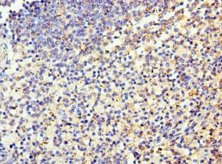 EZH1 / ENX-2 Antibody