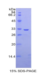 Rat CA2 / Carbonic Anhydrase II Protein (Recombinant His)